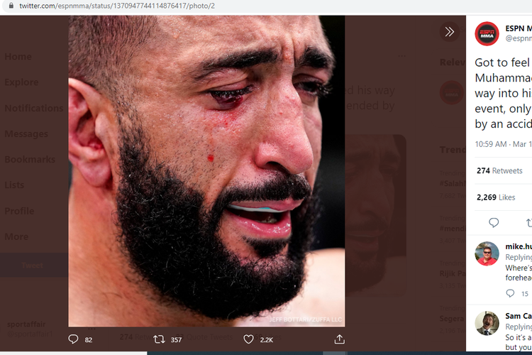 Petarung UFC, Belal Muhammad, setelah terkena colok lawannya, Leon Edwards, pada UFC Vegas 21, Minggu (14/3/2021) siang WIB.