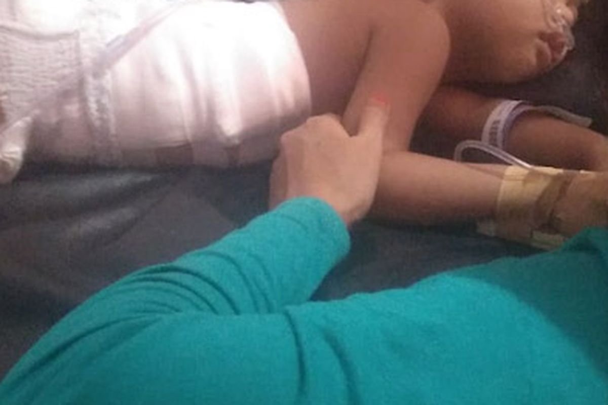 Bocah malang yang sempat menjadi korban teror monyet di Desa Kesambenwetan, Kecamatan Driyorejo, Gresik, Jawa Timur.