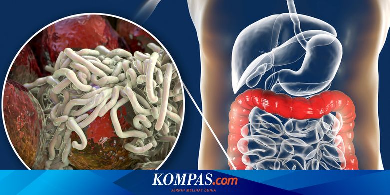 Parasit penyakit manusia jenis menyebabkan gambar itu