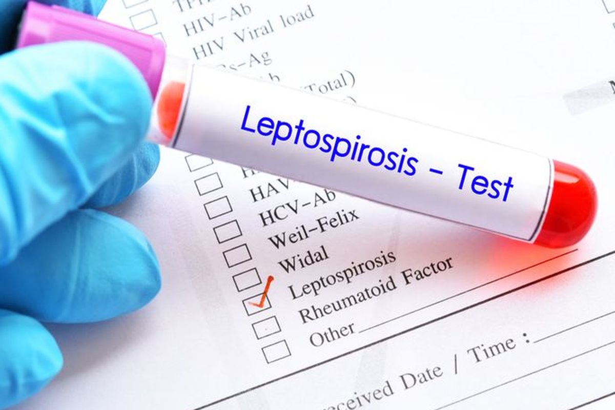 Pada Kamis (10/7/2025), Dinkes Yogyakarta melaporkan terdapat tambahan 19 kasus leptospirosis dengan enam kematian per 8 Juli 2025.