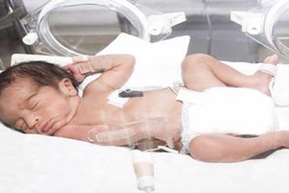 bayi mendapat perawatan di inkubator