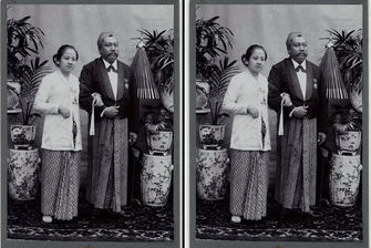 RA Kartini Meninggal karena Preeklampsia, Ini Penjelasan Penyakitnya