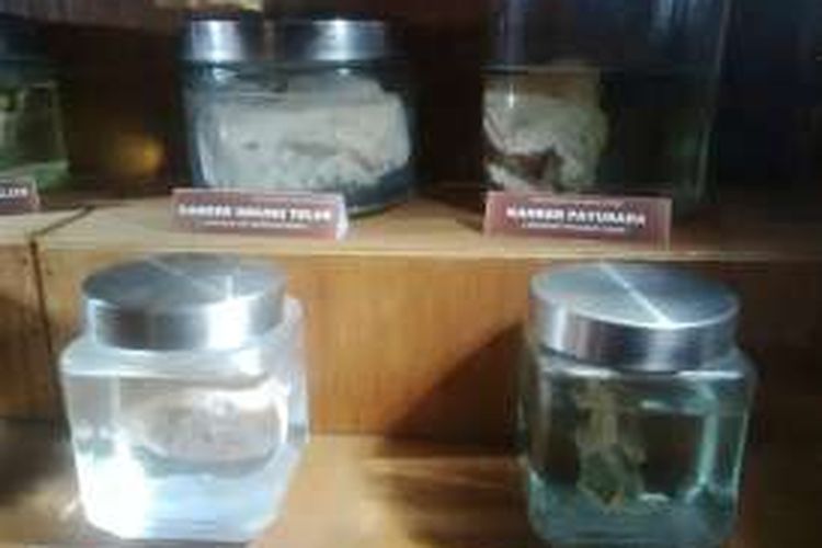 Potongan berbagai jenis kanker diawetkan dan dipamerkan di Museum Kanker Surabaya, Rabu (27/4/2016)