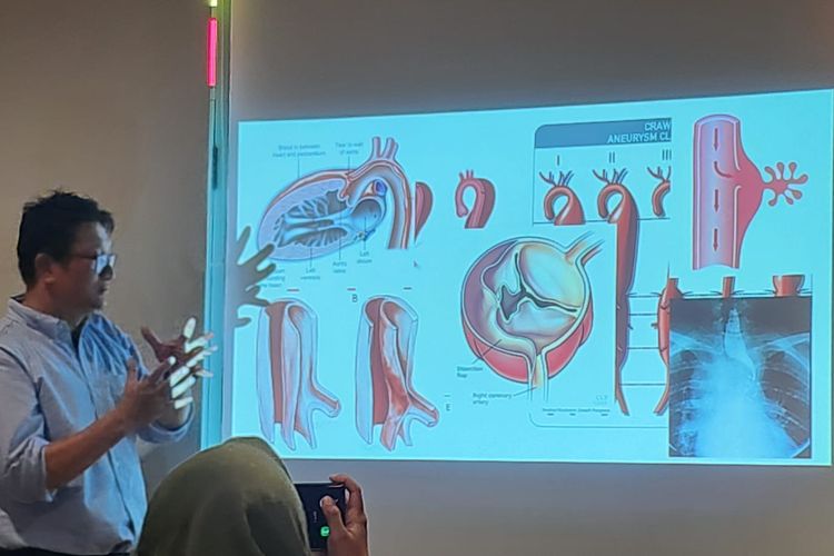 Penyakit Aorta Kompleks Bisa Fatal dalam Hitungan Jam, Ini yang Perlu Diwaspadai