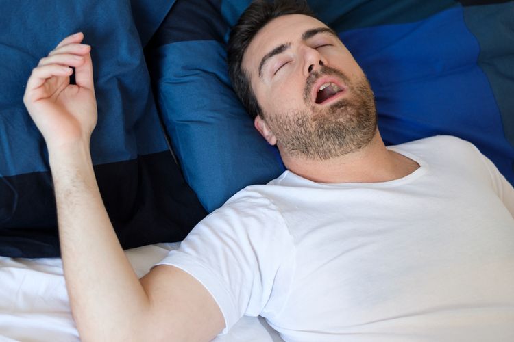 Ilustrasi apakah sleep apnea bisa disembuhkan?