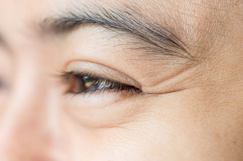 4 Penyebab Mata Keriput dan Cara Menghilangkannya