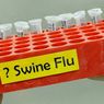 Flu Babi