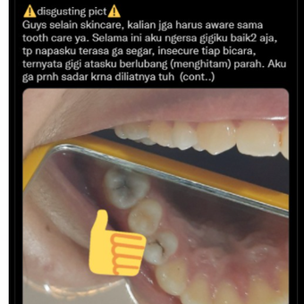 Tangkapan layar unggahan soal gigi hitam/gigi berlubang disebut bikin bau mulut.