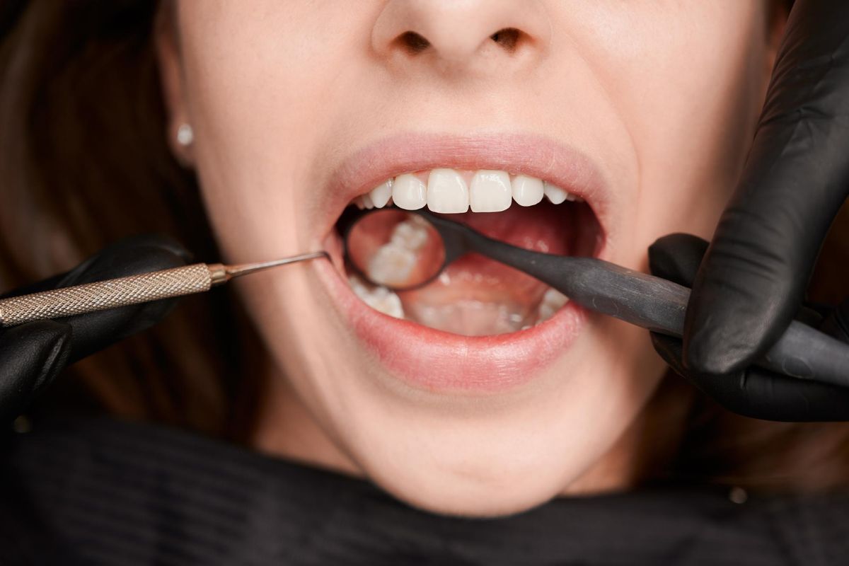 Ilustrasi perawatan gigi.