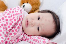 Cara Pengobatan dan Perawatan Demam Berdarah pada Bayi