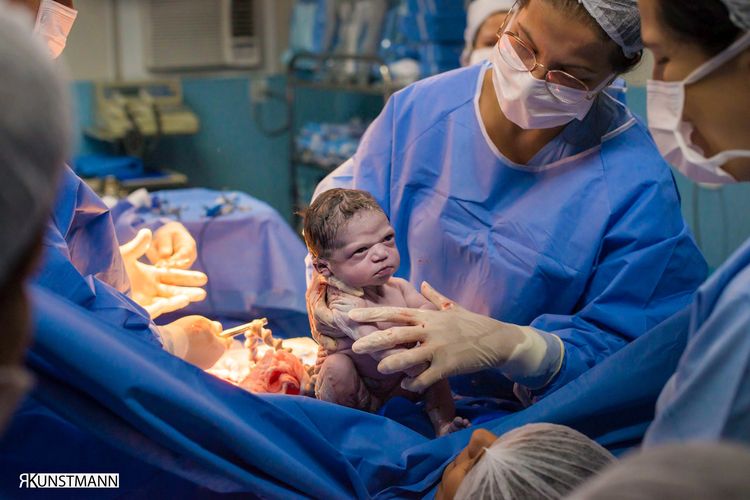 Foto bayi yang baru lahir dari proses operasi sesar tunjukkan raut muka marah