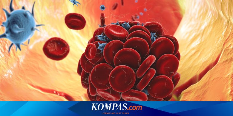 Penyakit Darah Kental Gejala Penyebab Pengobatan 2836