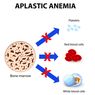 Anemia Aplastik