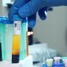 Alasan Wanita yang Pernah Hamil Tak Boleh Jadi Donor Plasma Konvalesen