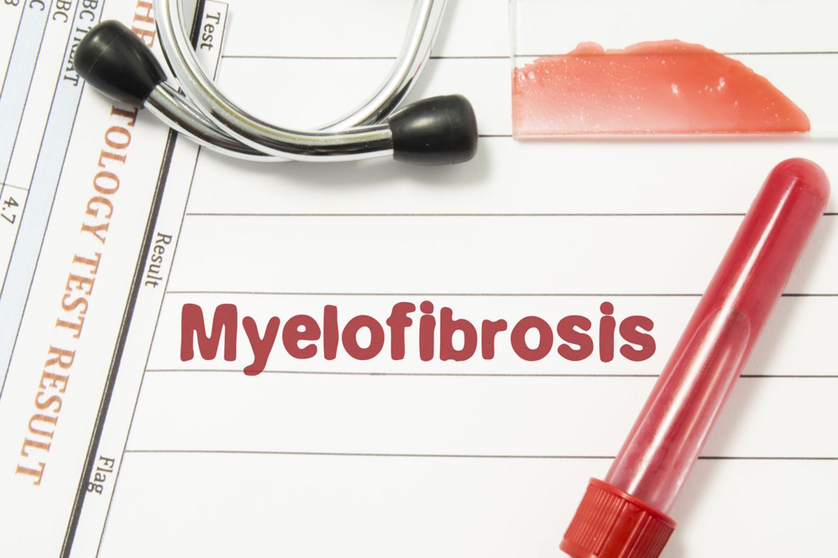 Ilustrasi  Myelofibrosis