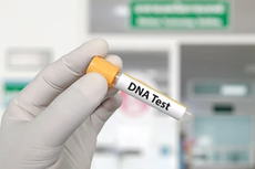 Bukan Hanya untuk Mengecek Garis Keturunan, Tes DNA Bisa Prediksi Risiko Penyakit