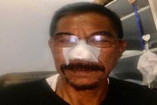 Detik-detik Hidung Mantan Bupati Boltim Digigit hingga Putus,  Kapolres Dimaki-maki Pelaku, Diduga karena Utang