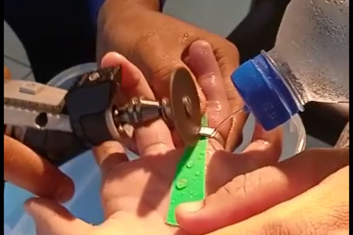 Petugas Damkar Ciamis bekerja sama mengeluarkan cincin yang terjebak di jari manis korban di ruang rawat RSUD Ciamis, Sabtu (8/1/2022). Petugas menggunakan alat mini grinder dan air dingin untuk mencopot cincin.
