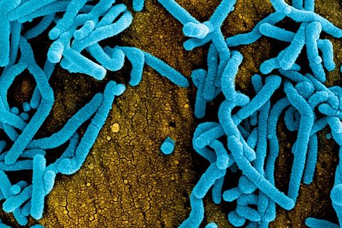 Virus Marburg Tewaskan Warga Ghana, Virus Apa Itu dan Apakah Bisa Dihindari?