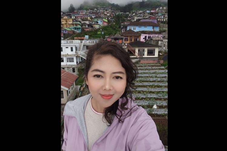 Kisah Asri Melawan Lupus, 8 Tahun Alami Gejala hingga Tinggalkan Karier di PBB
