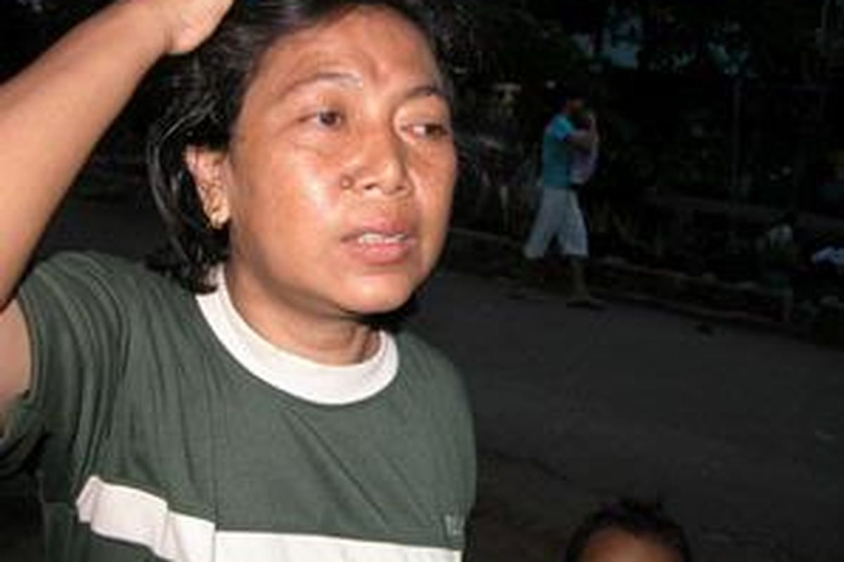 BEDAH OTAK GRATIS - NY Jumiati (48), penderita kanker otak yang menjalani operasi gratis di RS Siloam Karawaci. Ibu tiga anak ini menunjukkan bekas pembedahan pada tengkorak kepalanya.  