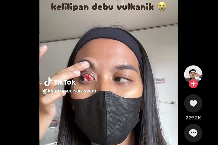 Viral Mata Berdarah Kena Abu Vulkanik, Ini Kata Dokter