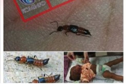 Viral Semut Charlie Berbahaya di Medsos, Hewan Apa Itu Sebenarnya?