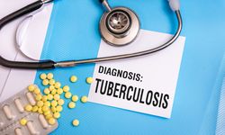 Kasus TBC Sensitif Obat Capai 808.000 Kasus Tahun Lalu