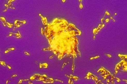Ilmuwan AS Ciptakan Alat Pendeteksi Bakteri dalam Hitungan Menit