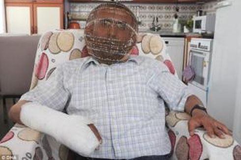 Ingin Berhenti Merokok, Pria Turki Kenakan Kurungan Kepala