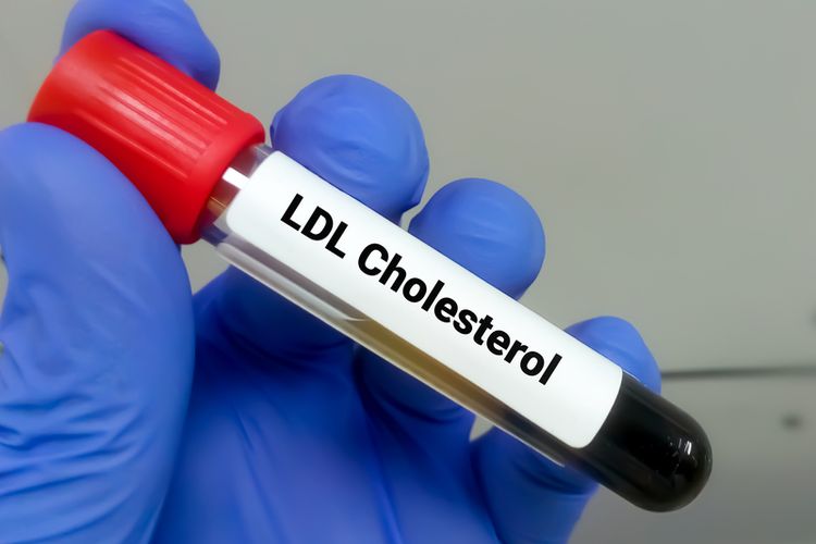 Ilustrasi kolesterol LDL. Kolesterol Anda sangat rendah, jika kadarnya dalam darah kurang dari 120 mg/dL. Kondisi ini baru akan menimbulkan gejala, jika Anda tidak sehat.