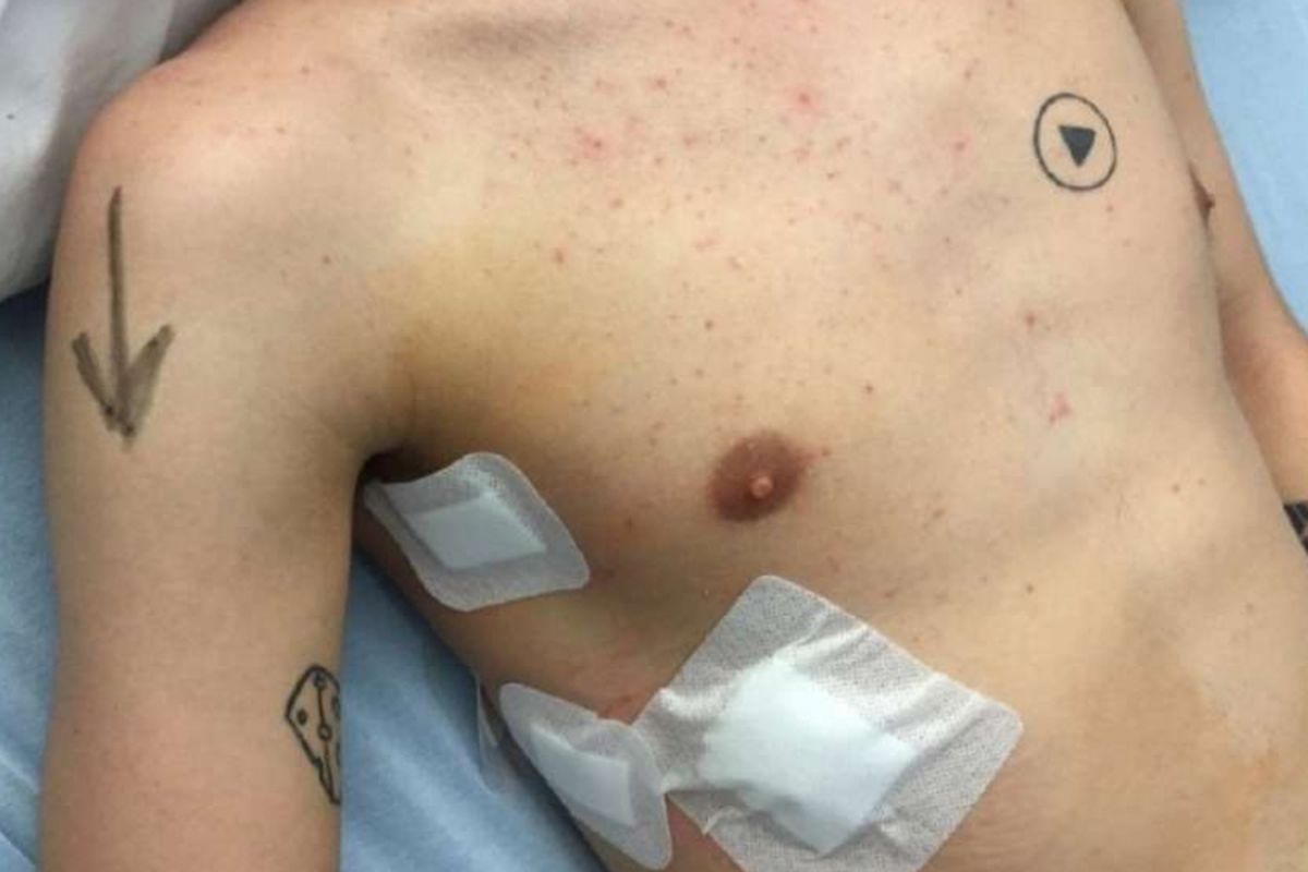 Mans play button tattoo almost creates huge surgery mishap

METRO GRAB taken from: http://casereports.bmj.com/content/2018/bcr-2017-223704.full.pdf

Credit: BMJ Case Reports