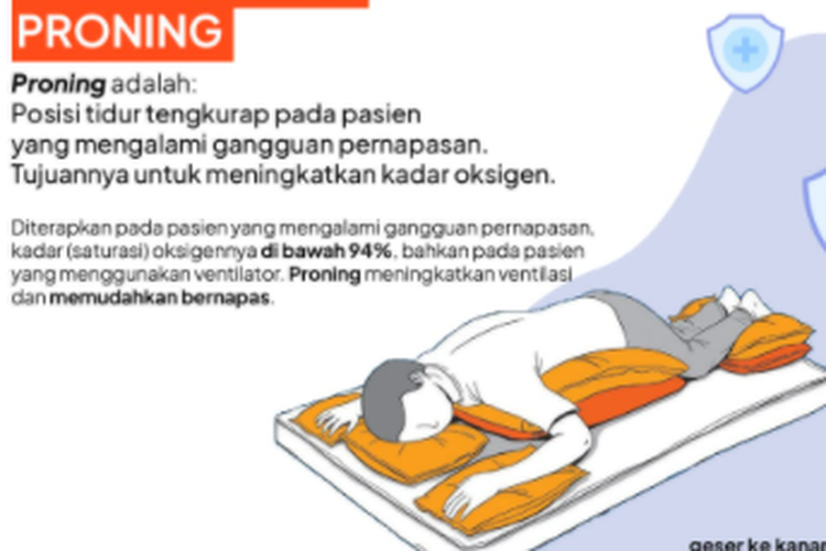 Ilustrasi teknik proning.