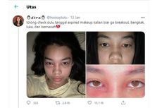 Viral Foto Wajah Bengkak karena Makeup Expired, Ini Kisahnya dan Penjelasan Dokter