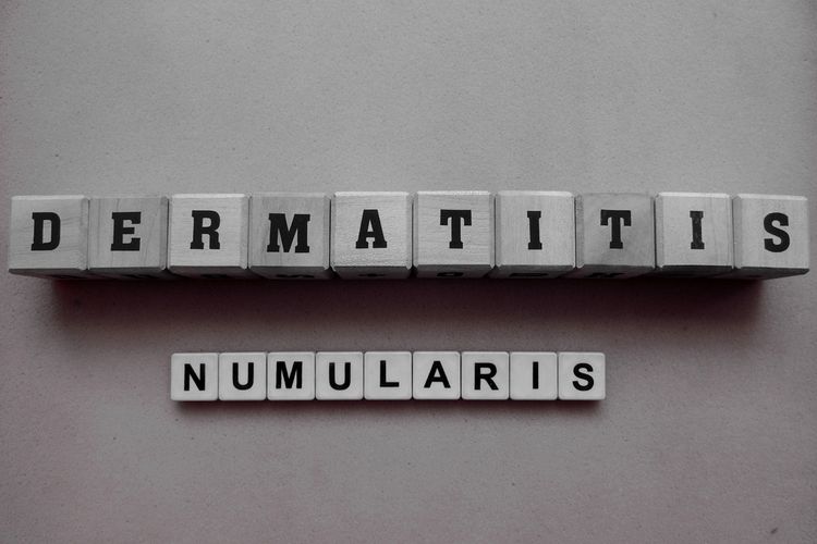 Ilustrasi Dermatitis Numularis