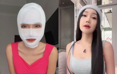 Lucinta Luna Lakukan Operasi Potong Leher untuk Hilangkan Jakun ...