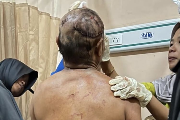 Pulang dari Kebun, Petani di Lampung Barat Diterkam Harimau