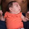 Sejarah Virus Zika, Penularan, Gejala, dan Pengobatannya
