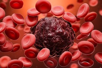 7 Gejala Kanker Darah Stadium Awal yang Perlu Diwaspadai