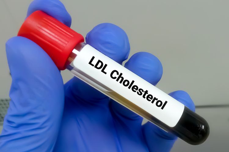 Berapa Kadar Kolesterol LDL Normal?