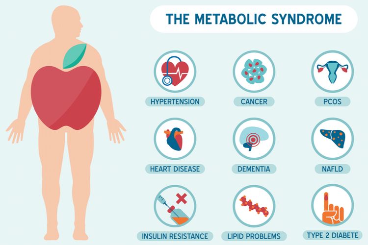 Ilustrasi sindrom metabolik