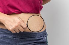 3 Cara Menghilangkan Stretch Mark, Bisa dengan Minyak Kelapa