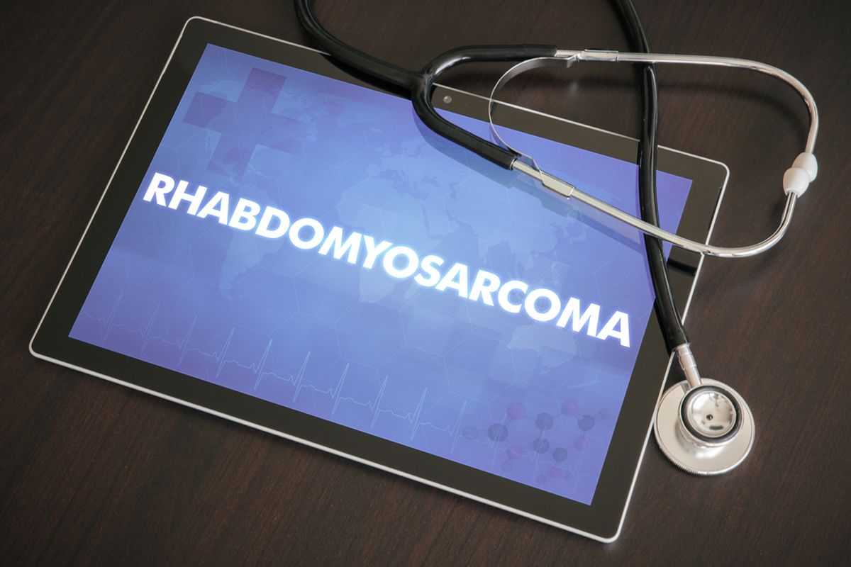 Ilustrasi Rhabdomyosarcoma