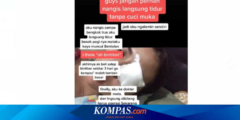 Viral Unggahan Soal Menangis Terlalu Lama Diduga Dapat Menyebabkan Bintitan Ini Penjelasan Dokter Halaman All Kompas Com