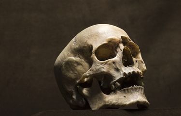 Trepanasi adalah praktik pengobatan kuno dengan melubangi tengkorak.