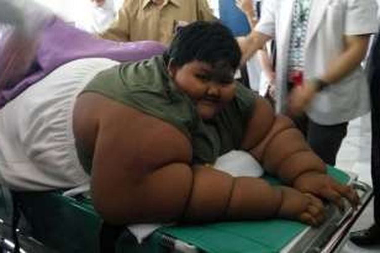 Arya Permana (10) penderita severe obesity ditangani 13 dokter spesialis RSHS. Berat badan normal Arya kurang dari 50 kg, namun saat ini beratnya mencapai 189,5 kg. 