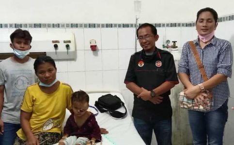 Toddler with Tennis Ball-Sized Tumor in His Eye Needs Surgery Assistance in Indonesia's North Sumatera