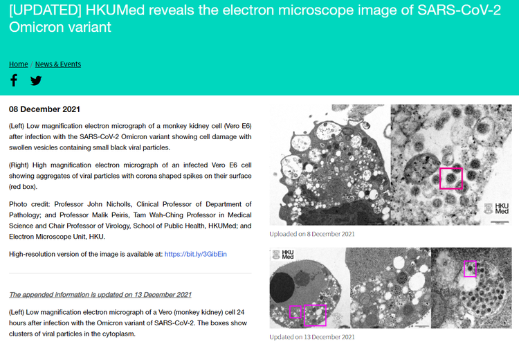 Tangkapan layar laman Universitas Hong Kong, pada 8 Desember 2021, yang menampakkan foto mikrograf elektron pembesaran rendah dari sel ginjal monyet (Vero E6) yang terinfeksi varian Omikcon SARS-CoV-2.