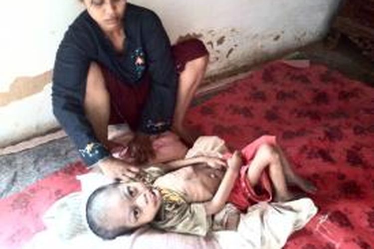 Khotim bersama anaknya Fahmi yang tubuhnya tinggal tulang. Fahmi dibiarkan tinggal tulang karena tidak punya biaya untuk berobat. 