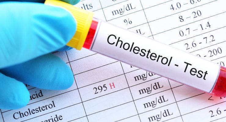 Apakah Kolesterol Tinggi Bisa Dideteksi Melalui Gejala?